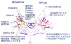 腰椎间盘突出不治疗的危害