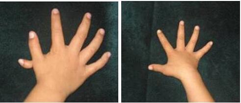 1532314374122545.jpg
